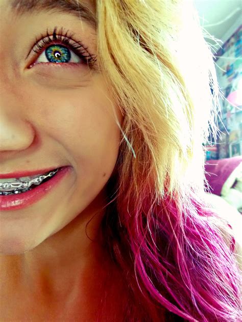 Girls With Braces On Twitter Loving This Colorful Picture Braces