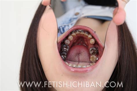 japanese dentist fetish