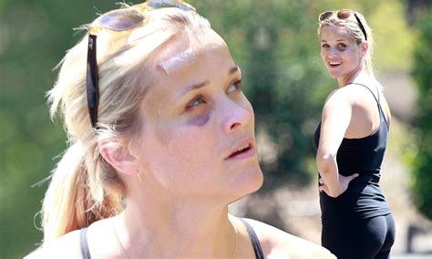 reese witherspoon shrugs off her injuries as she takes up jogging again