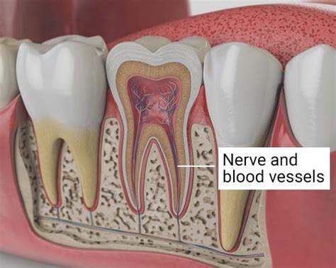 tooth nerve pain relief therapy   bronx ny