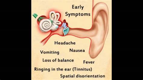 ear infection symptoms youtube