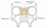 Sinus Surgery Endoscopic Paranasal Recess Sinuses Into Ethmoidal Drain Posterior Drainage Superior Sphenoid Turbinate Drains Meatus Under sketch template