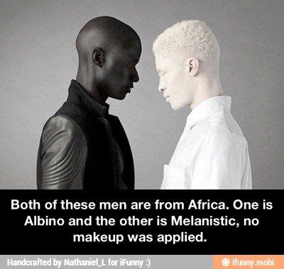 image result  melanism melanism albino human