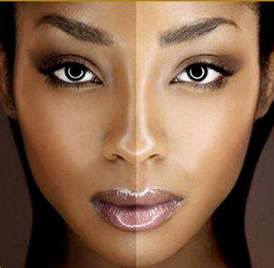 healthy  beauty tips dark skin removal treatment  dark skin