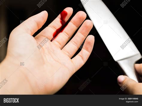 finger cut  knife
