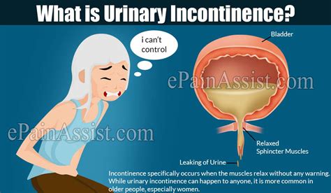 Can A Prolapsed Bladder Cause Uti 2023