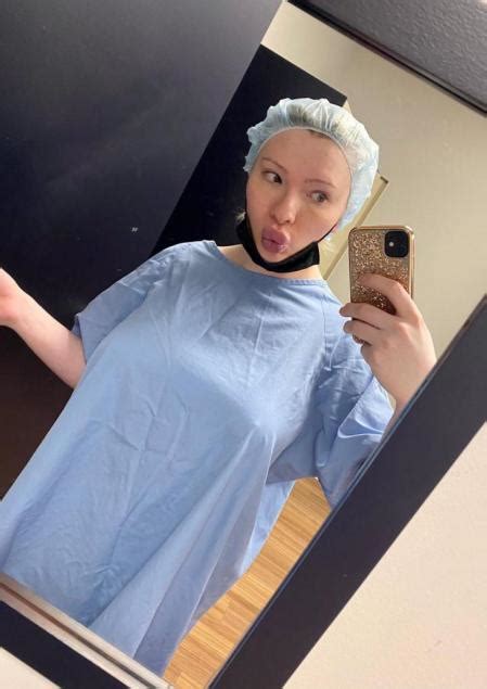 una joven gasta más de 50 000 dólares en cirugías para parecerse a