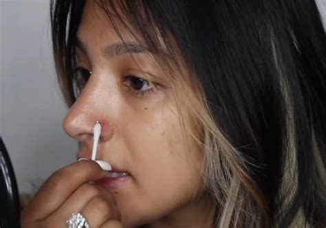 10 tips to treat an infected nose piercing