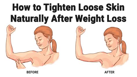 how to tighten loose skin naturally after weight loss