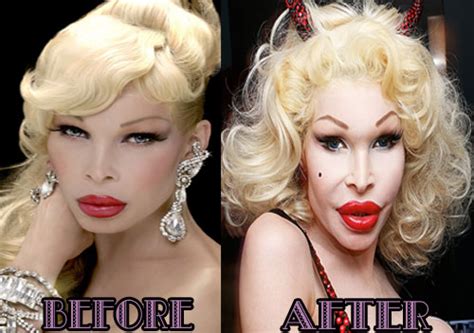 Amanda Lepore As A Man Before And After Plastic Surgery