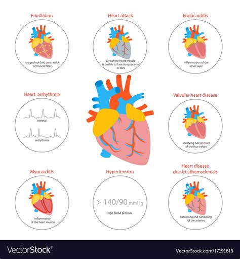 cartoon heart disease infographic card  poster vector image