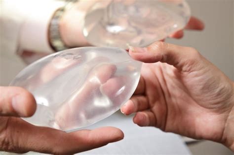Why Thousands Of Women Are Having Their Breast Implants Removed Fox News