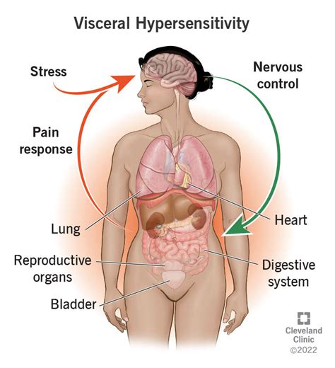 visceral hypersensitivity symptoms treatment