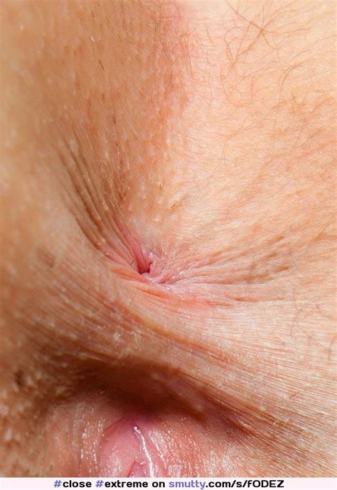 Extreme Close Up Super Closeup Asshole An Image By Jocloud
