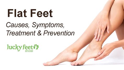 flat feet  symptoms treatment prevention lucky feet shoes