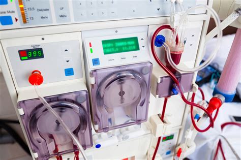 frequent dialysis improves health  kidney patients national