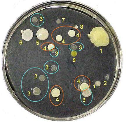 bacterial colony morphology biology libretexts