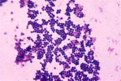 staphylococcus aureus   type  bacteria  stains