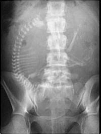 X-ray : Wikis (The Full Wiki)