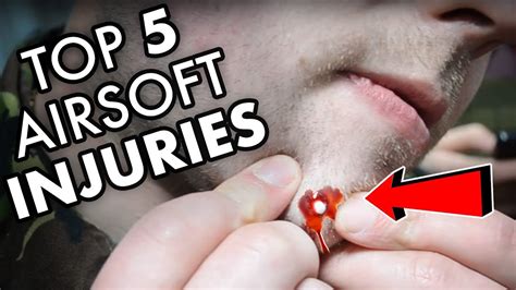 Top 5 Des Pire Blessures Airsoft Airsoft Factory