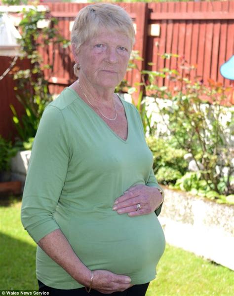Grandmother Looks Pregnant Because Two Huge Hernias The