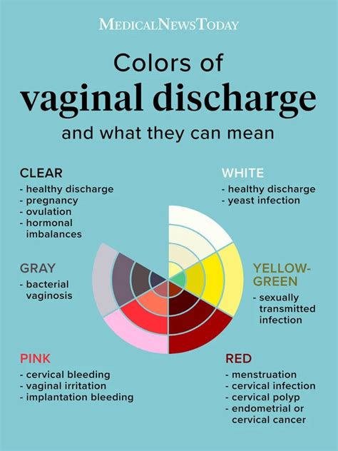 Vaginal Discharge Definition A Guide