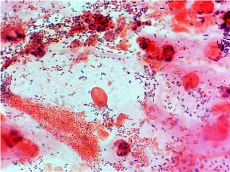 File Bacteria Gram Stained Vaginal Smear 11  Embryology