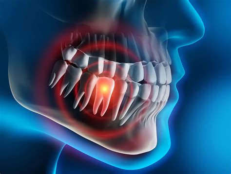 livonia dentist    importance  treating  aching tooth