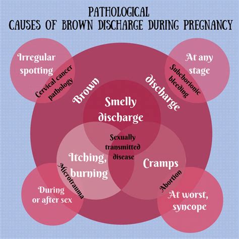 is brown discharge a sign of pregnancy find out now all about implantation bleeding