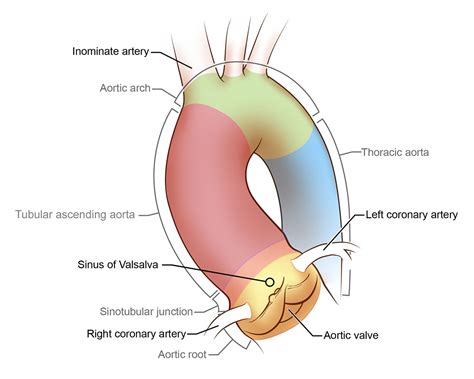 bicuspid aortic valve  aortic aneurysm  behance