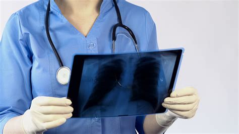 Therapist Looking On Lungs Xray And Making A Diagnosis Patients