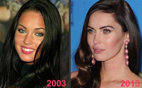 Megan Fox Before And After Plastic Surgery A Tale Of