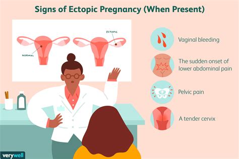 ectopic pregnancy  saved