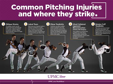 common baseball pitching injuries   strike