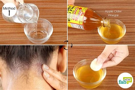 Apply Diluted Apple Cider Vinegar On Your Scalp And Other