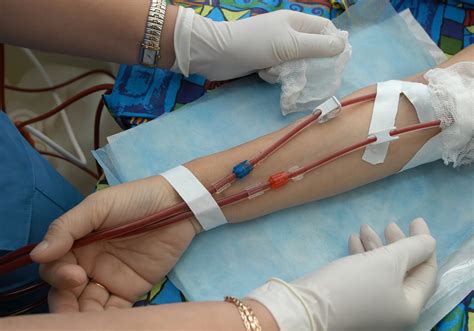 dialysis nephromed associates