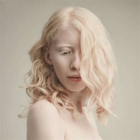modelos albinos  demuestran  lo diferente es igualmente bello