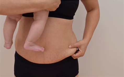 buik na bevalling zwangerschap tips hoestrakke buik en slappe hangbuik vermijden mamaliefdenl