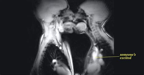 what does sex look like from the inside footage from an mri scanner