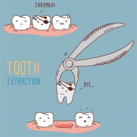 tooth extraction eagle rock dental care