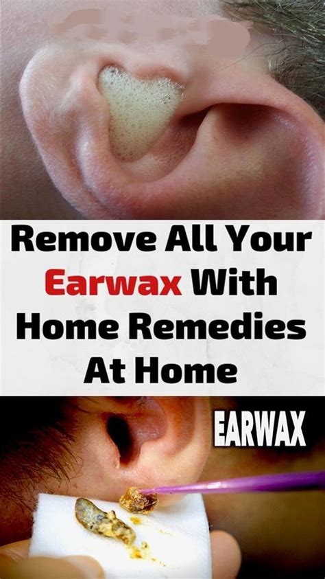 remove   earwax  home remedies  home clean ear wax