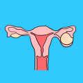 twisted ovaries  red flag symptoms women    ignore littlethingscom