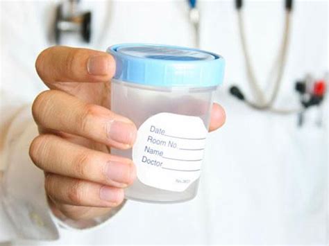 how to collect a semen sample trak fertility