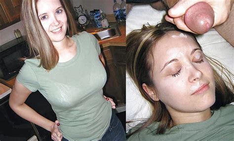 before and after facial porn pictures xxx photos sex images 3967357