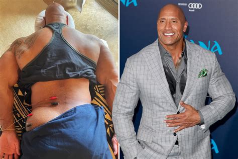 Dwayne The Rock Johnson Shows Off His Butt And Undergoes Acupuncture