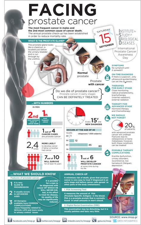 Facing Prostate Cancer Infographic