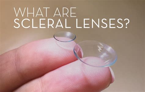 scleral lenses eye doctors chicago village eyecare