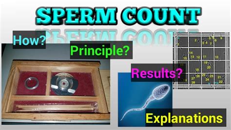 Sperm Count Sperm Analysis Sperm Counting Procedure Motility How To Do