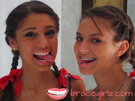 two cute tanned girls one of the girl with braces braces girls brace face tan girls