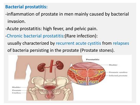 Ppt Lower Urinary Tract Infection Powerpoint Presentation Free